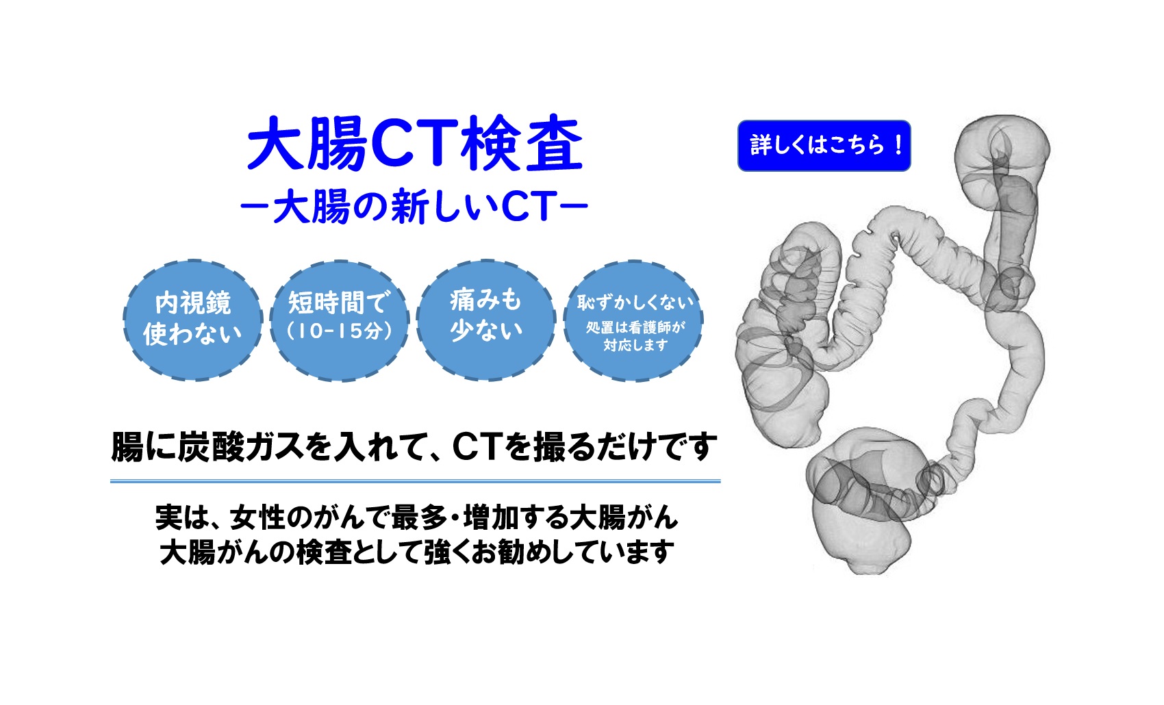 大腸ＣＴ検査